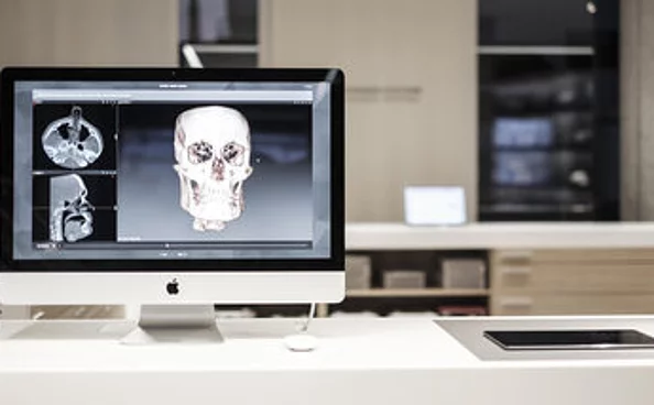 Patientenspezifische Implantate IPS Implants® IPS CaseDesigner