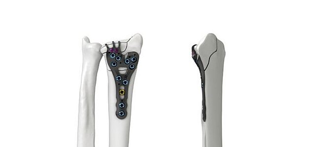 Erweiterung Ixos® Portfolio Erweiterung Ixos® Portfolio