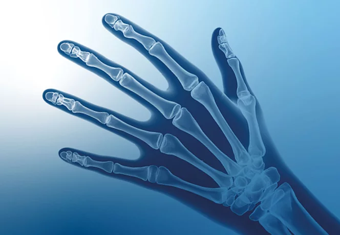 Obere Extremitäten Obere Extremitäten